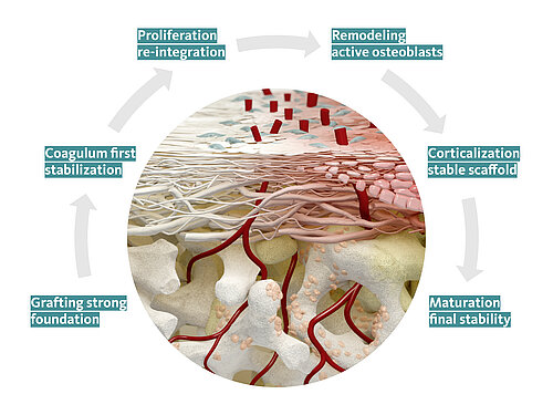 From grafting to maturation of Geistlich Bio-Gide®