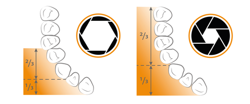 Fig. 1: Example of how the depth of field (highlighted in the orange area) changes depending on the aperture of the diaphragm.