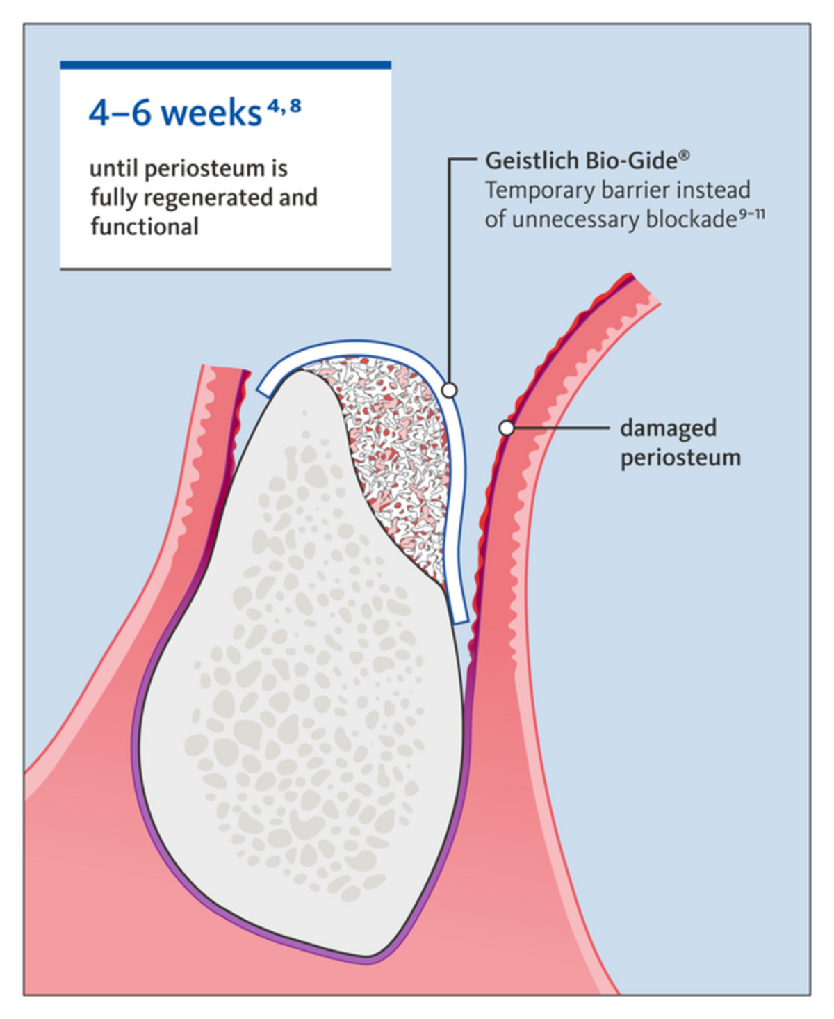 [Portuguese] Explanation about damaged periosteum and barrier time