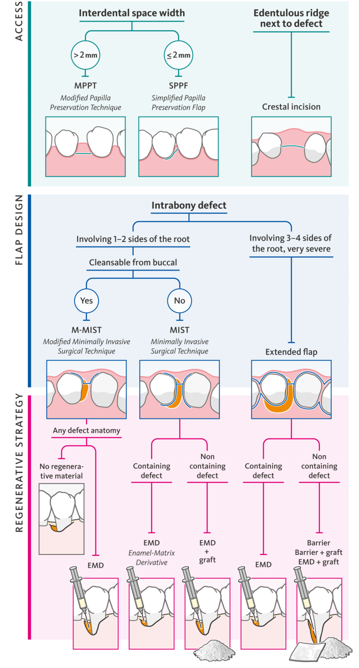 ABB. 1: Behandlungsalgorithmus für die regenerative Parodontaltherapie