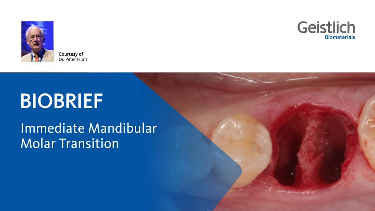 Extraction Socket Management - Immediate Mandibular Molar transition