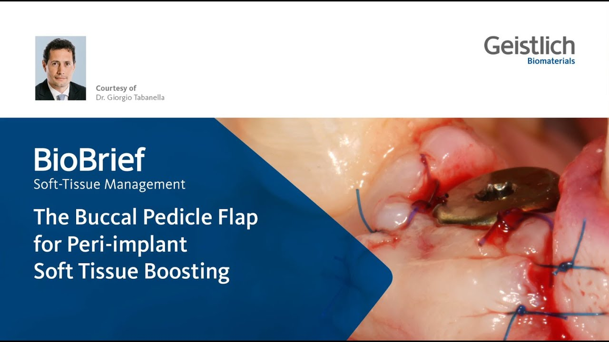 Dr. Giorgio Tabanella - The Buccal Pedicle Flap for Peri-implant Soft Tissue Boosting