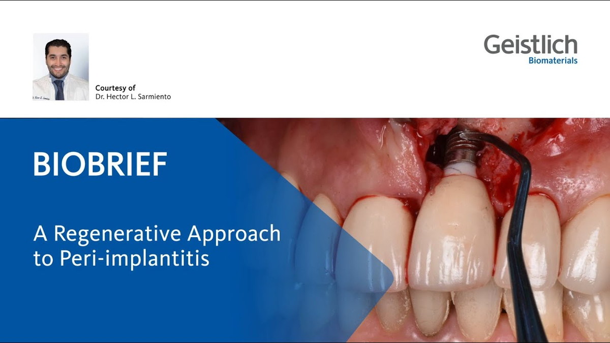 Hector L. Sarmiento, D.m.D., msc. - A Regenerative Approach to Peri-implantitis