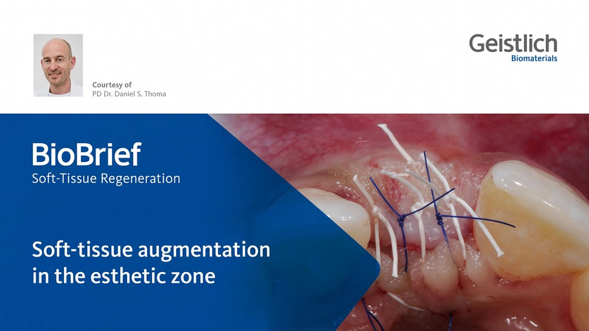 PD Dr. Daniel S. Thoma - Soft-tissue augmentation in the esthetic zone