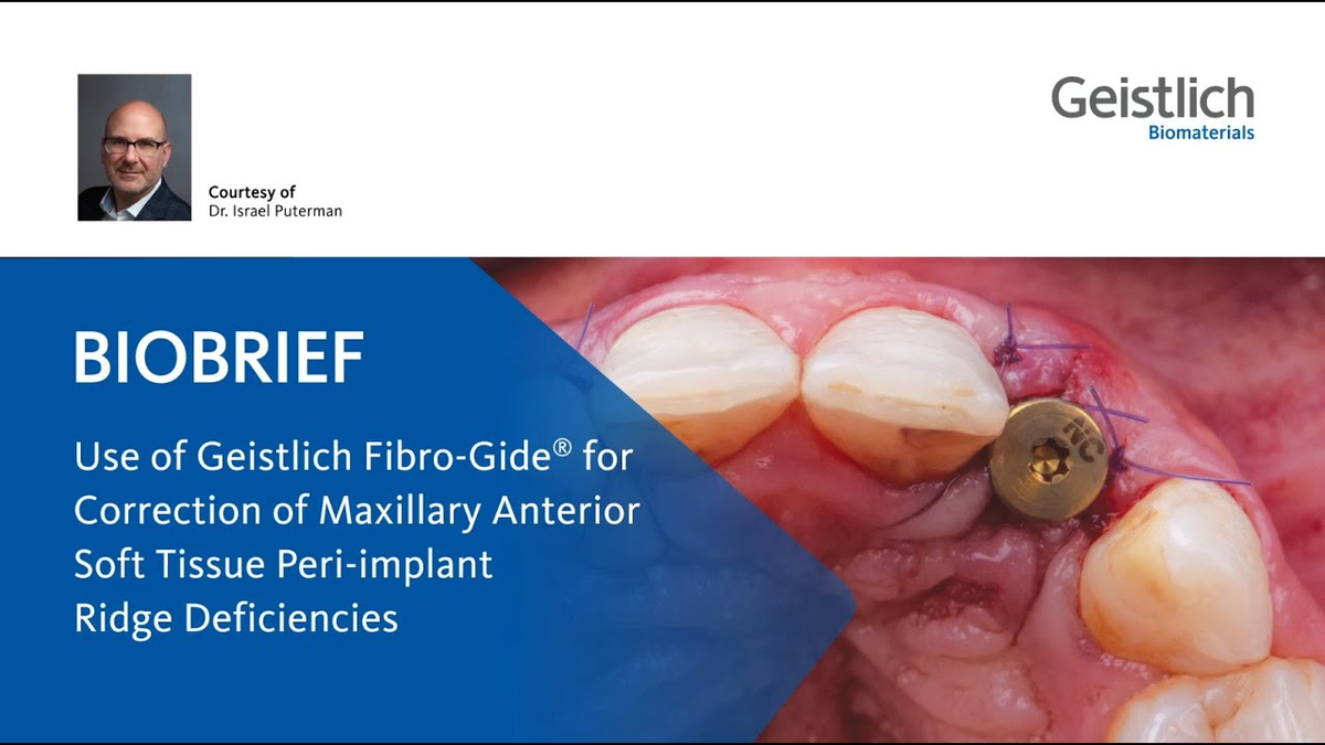 Soft-Tissue Regeneration - Israel Puterman, D.m.D., M.s.D.